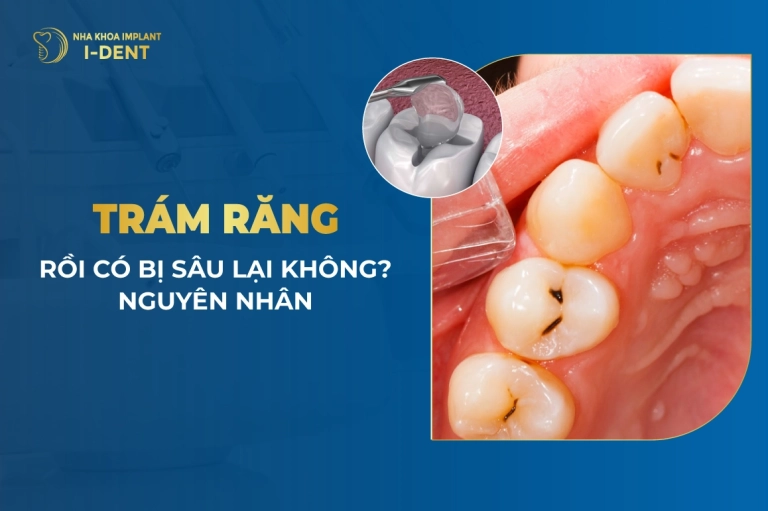Tram-Rang-Roi-Co-Bi-Sau-Lai-Khong-Nguyen-Nhan