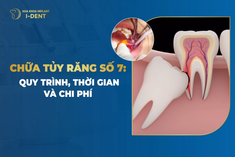 chua-tuy-rang-so-7-quy-trinh-thoi-gian-chi-phi