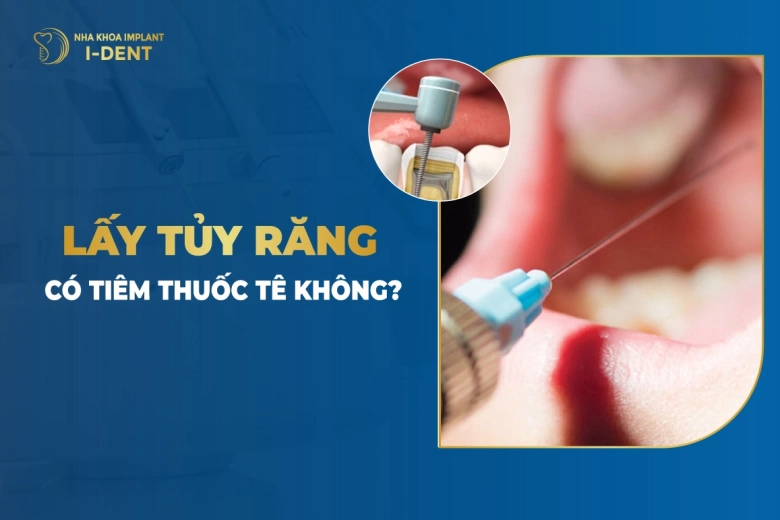 lay-tuy-rang-co-tiem-thuoc-te-khong