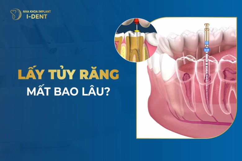 lay-tuy-rang-mat-bao-lau