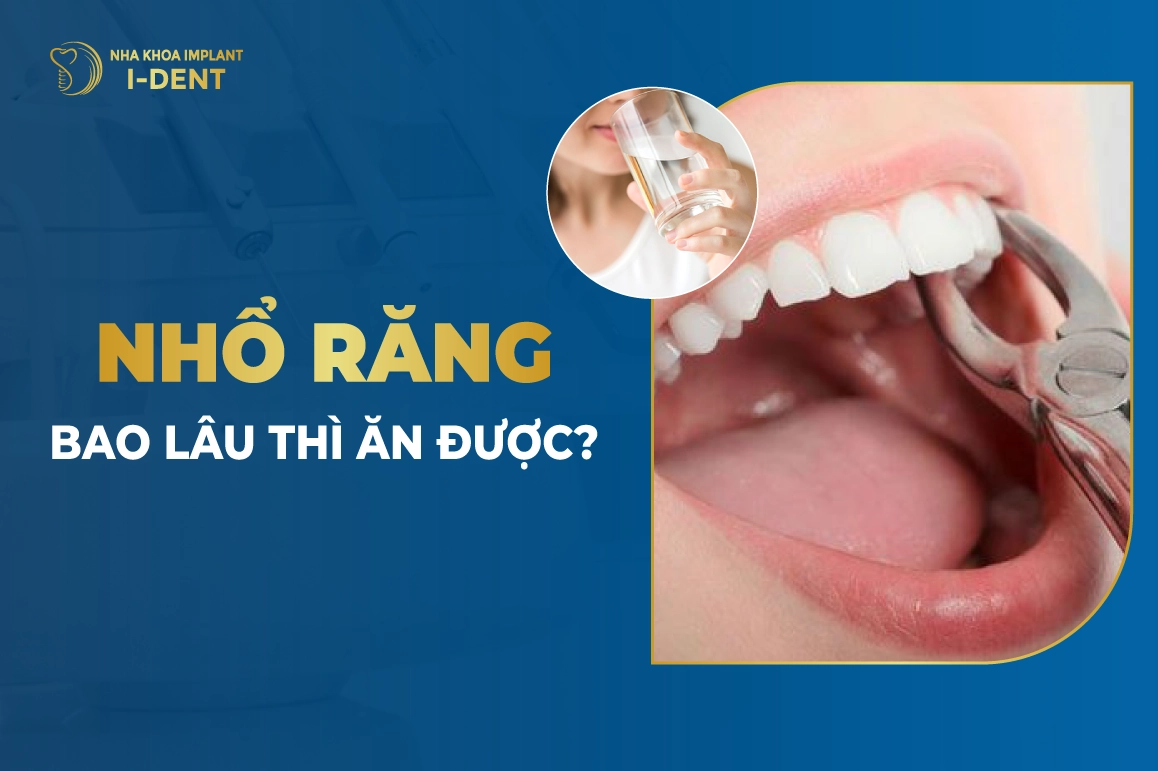 Sau Khi Nhổ Răng Bao Lâu Thì Được Ăn Uống