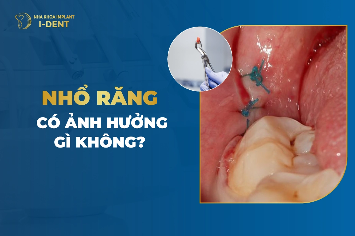 Nhổ Răng Có Ảnh Hưởng Gì Không?