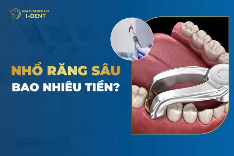 nho-rang-sau-bao-nhieu-tien