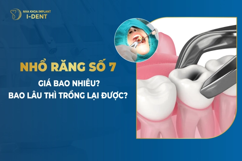 Nhổ Răng Số 7 Giá Bao Nhiêu? Bao Lâu Thì Trồng Lại Được?