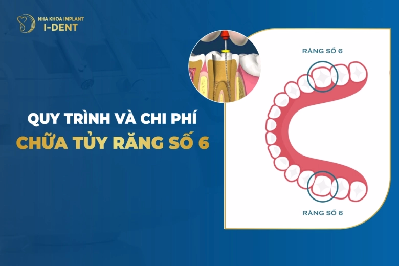 quy-trinh-va-chi-phi-chua-tuy-rang-so-6