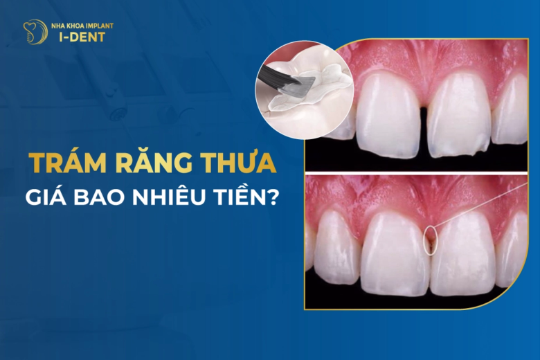 tram-rang-thua-bao-nhieu-tien