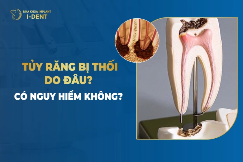 tuy-rang-bi-thoi-do-dau