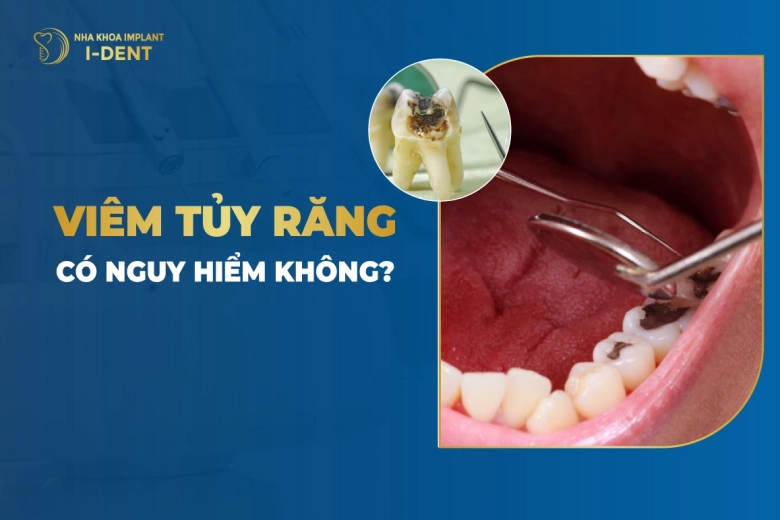 viem-tuy-rang-co-nguy-hiem-khong