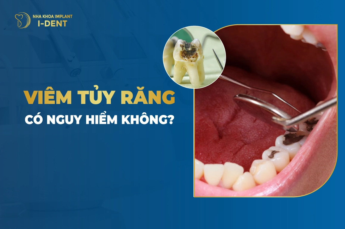 Viêm Tủy Răng Có Nguy Hiểm Không?