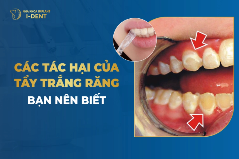 cac-tac-hai-cua-tay-trang-rang-ban-nen-biet