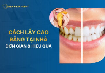 cách lấy cao răng tại nhà