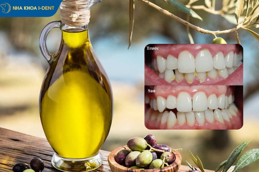cách loại bỏ cao răng lâu năm