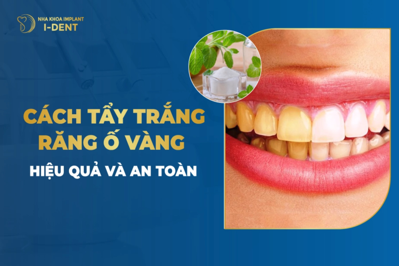 cach-tay-trang-rang-o-vang-hieu-qua-va-an-toan
