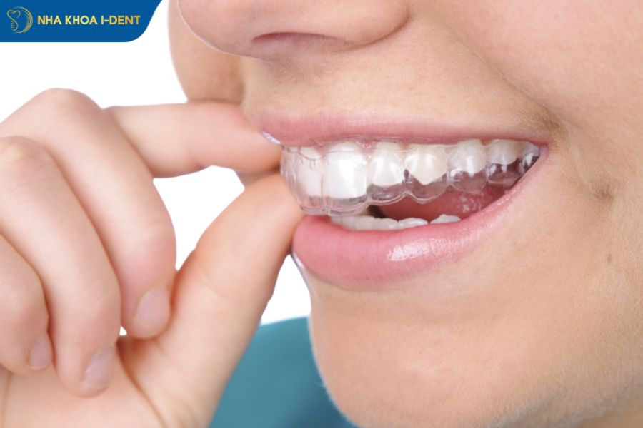 cách tẩy trắng răng tại nhà hiệu quả