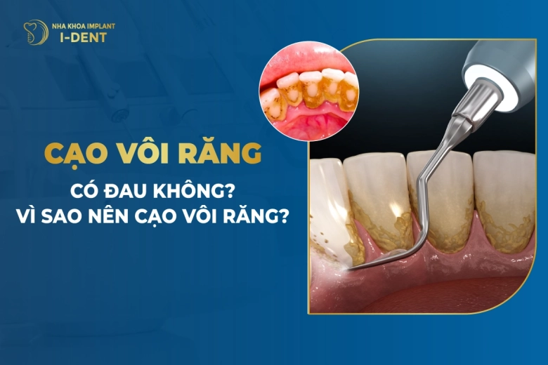 Cạo Vôi Răng Có Đau Không? Vì Sao Nên Cạo Vôi Răng?