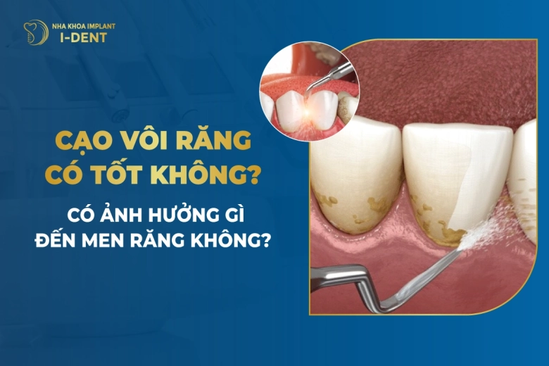 Cạo Vôi Răng Có Tốt Không? Có Ảnh Hưởng Đến Men Răng Không?