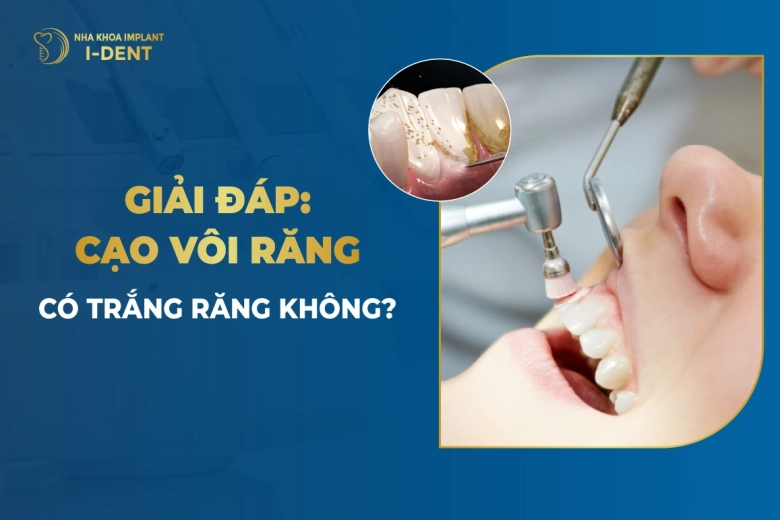 Giải Đáp: Cạo Vôi Răng Có Trắng Răng Không?