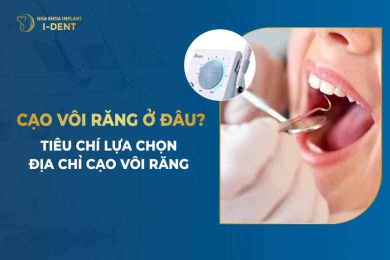 Cạo Vôi Răng Ở Đâu Tốt? Top 7 Nha Khoa Cạo Vôi Răng Uy Tín, Chất Lượng