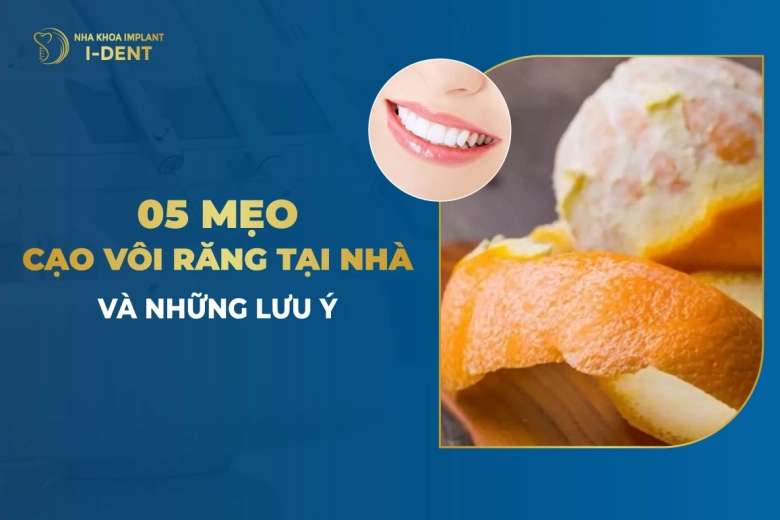 5 Mẹo Cạo Vôi Răng Tại Nhà Và Những Lưu Ý