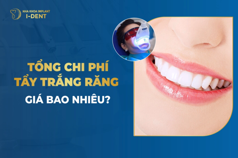 chi-phi-tay-trang-rang-bao-nhieu-tien