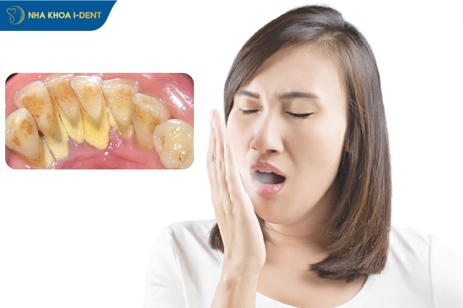 không lấy cao răng có sao không