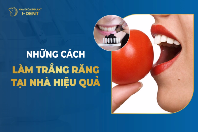 nhung-cach-tay-trang-rang-tai-nha-hieu-qua