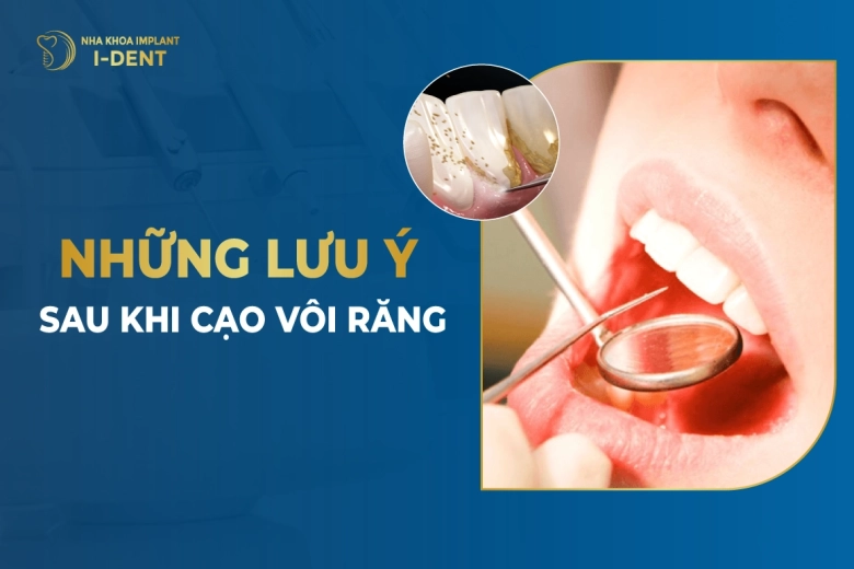 Những Lưu Ý Sau Khi Cạo Vôi Răng