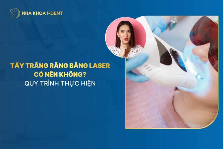 Tẩy trắng răng bằng Laser: Có nên không? Quy trình thực hiện
