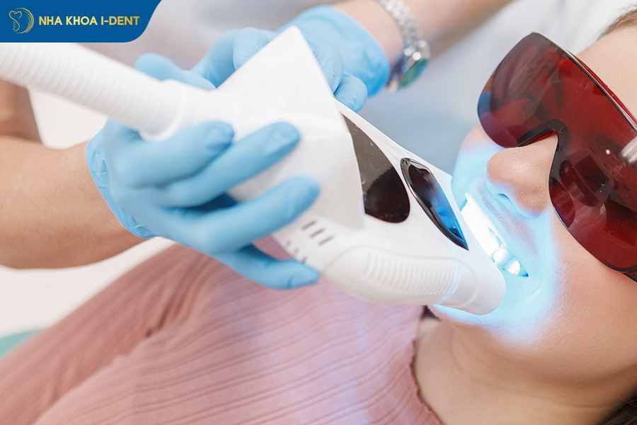 tẩy trắng răng bằng laser có tốt không