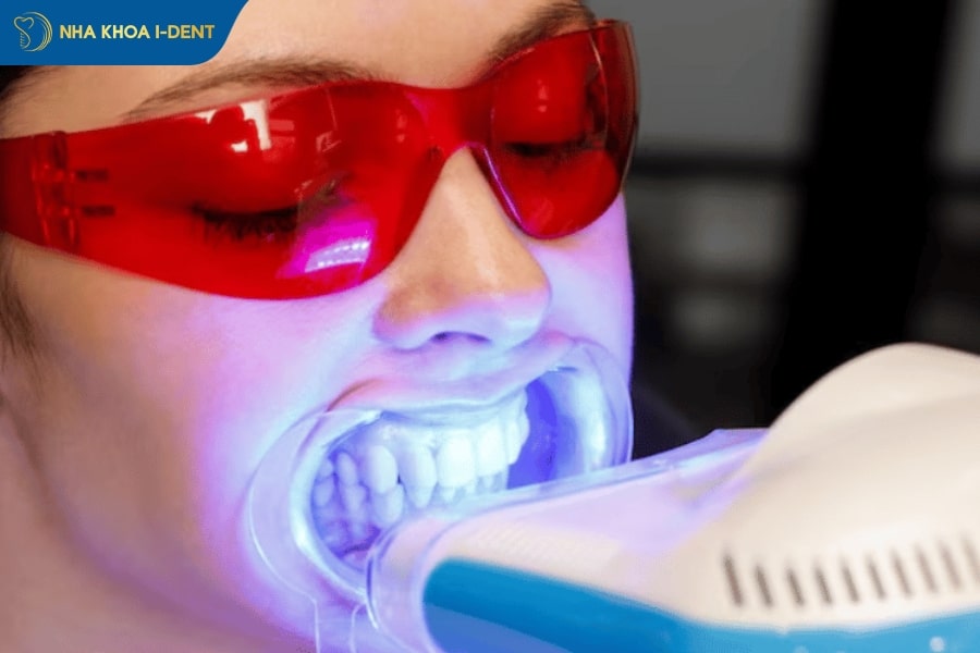làm trắng răng bao nhiêu tiền