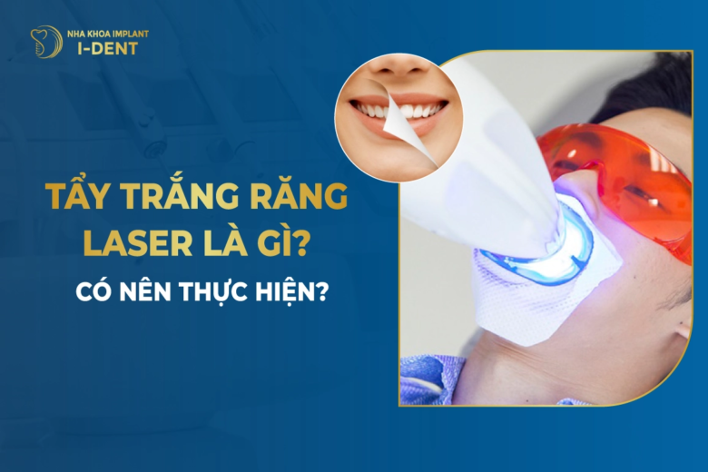 Tẩy Trắng Răng Laser Là Gì? Có Nên Thực Hiện?