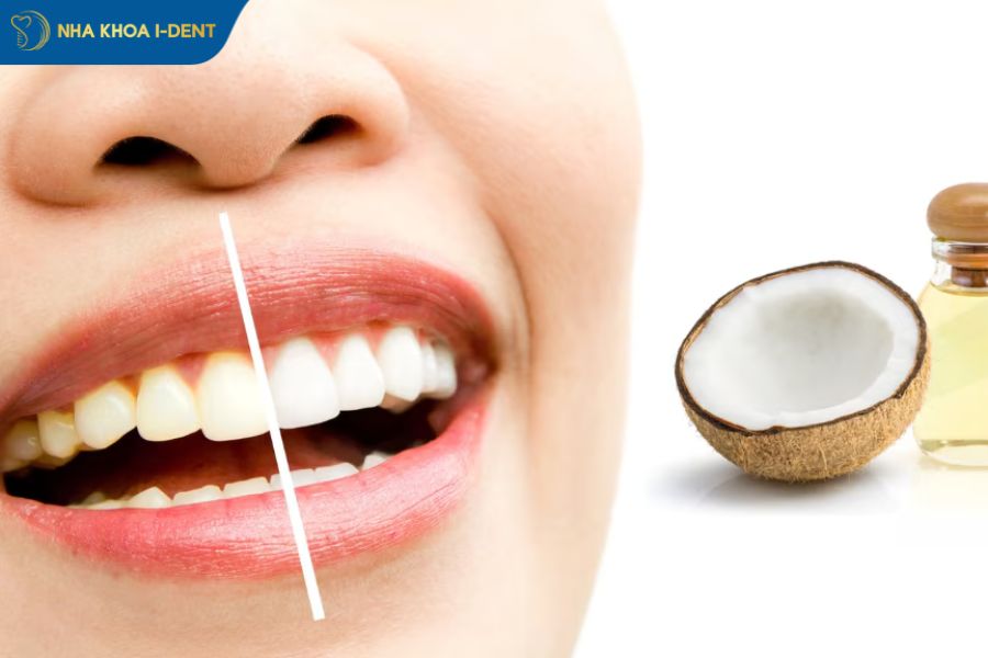 tẩy trắng răng tại nhà hiệu quả