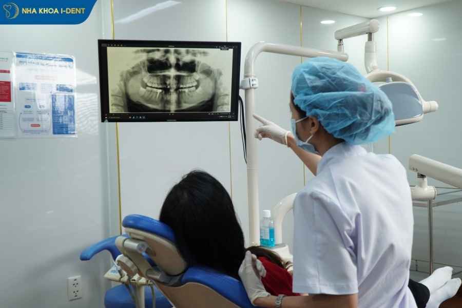 niềng răng cho răng thưa - Nha khoa I-Dent