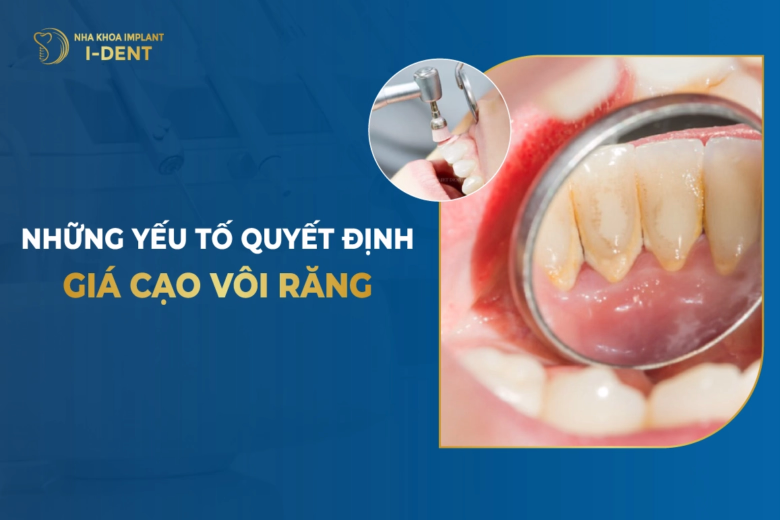 cạo vôi răng giá bao nhiêu