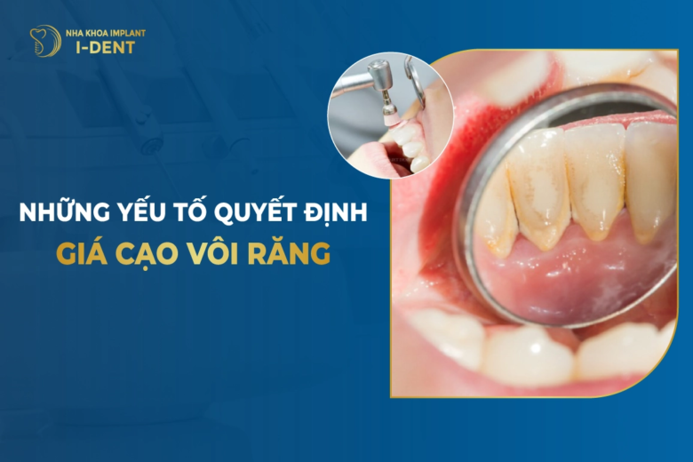 Cạo Vôi Răng Giá Bao Nhiêu?