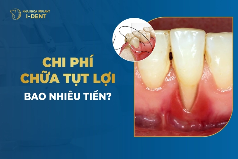 Chi Phí Chữa Tụt Lợi Bao Nhiêu Tiền?