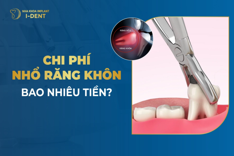 Chi Phí Nhổ Răng Khôn Bao Nhiêu Tiền?