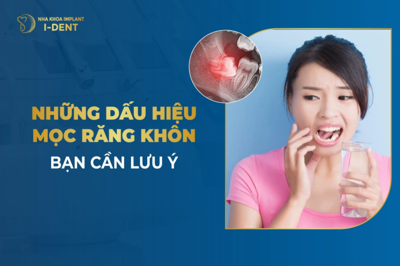 Những Dấu Hiệu Mọc Răng Khôn Bạn Cần Lưu Ý