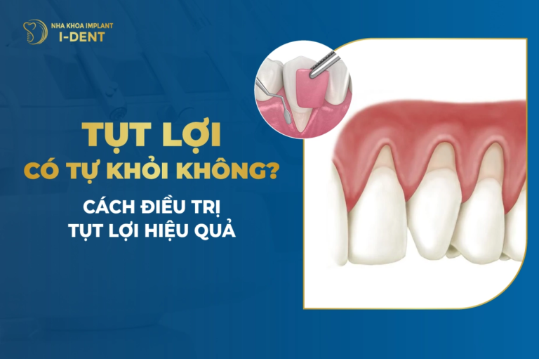 tut-loi-co-tu-khoi-khong
