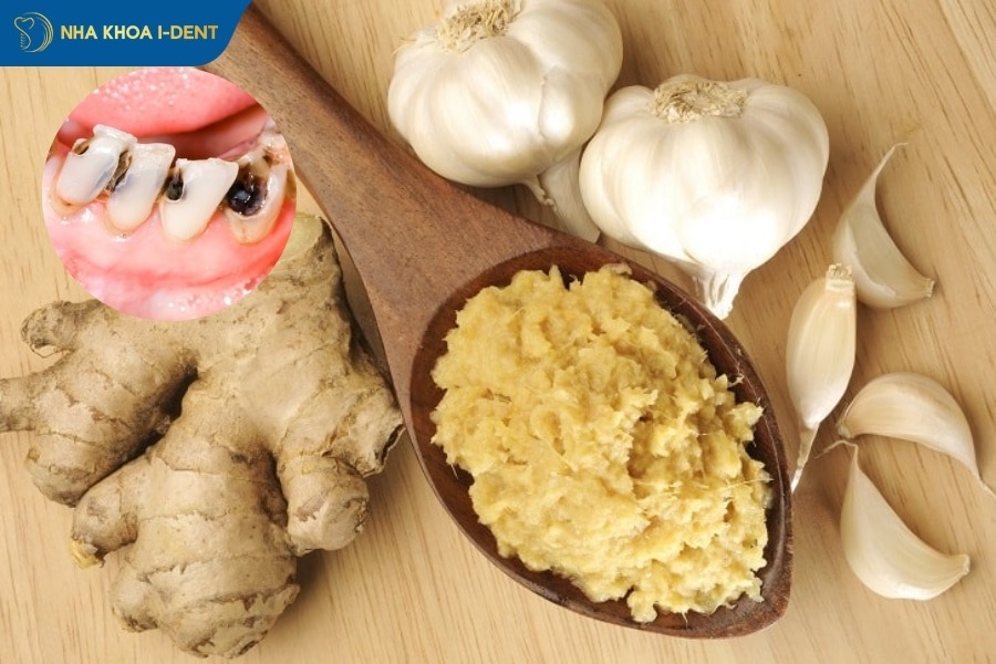 sâu răng nên làm gì để nhanh khỏi