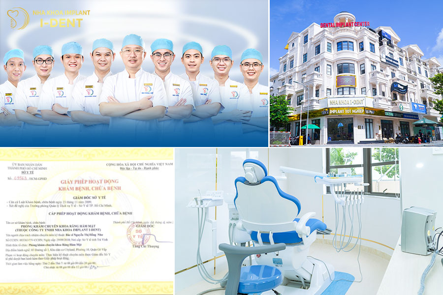 review trồng răng implant