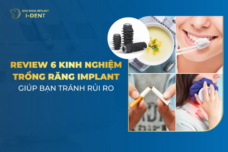 Review 6 Kinh Nghiệm Trồng Răng Implant Giúp Bạn Tránh Rủi Ro