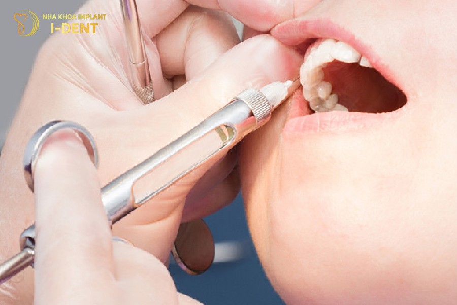 trồng răng implant có đau không