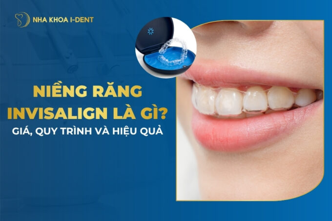 invisalign