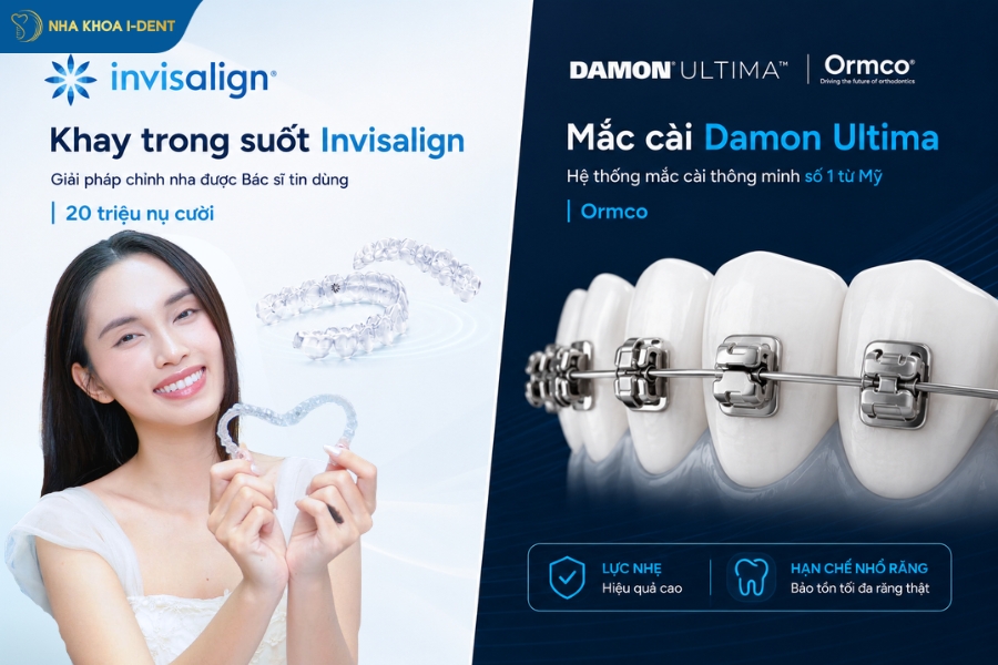 Nha khoa I-Dent sử dụng vật liệu chỉnh nha chính hãng từ các thương hiệu nổi tiếng