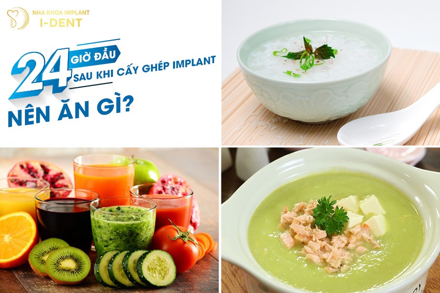 trồng implant nên ăn gì