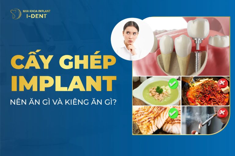 trồng răng implant nên ăn gì