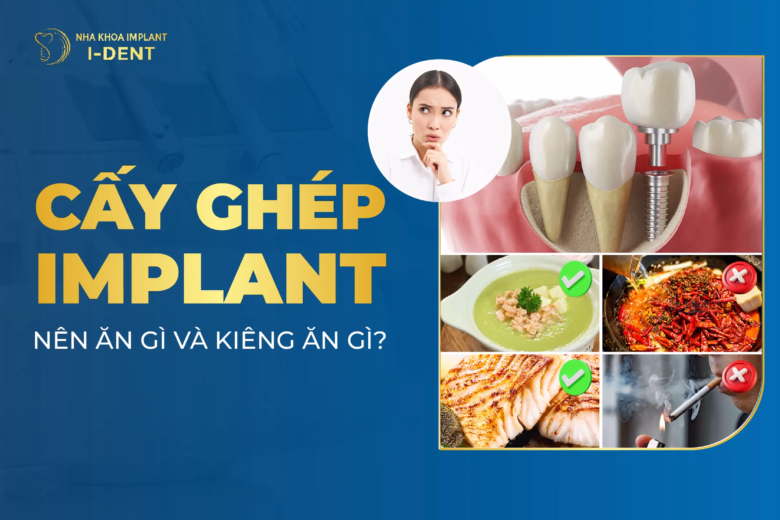 trồng răng implant nên ăn gì