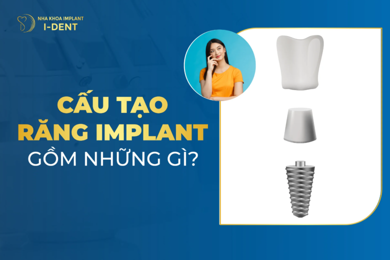 Cấu tạo răng Implant gồm những gì?