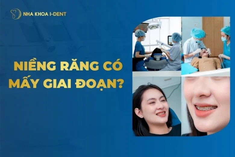 các giai đoạn niềng răng